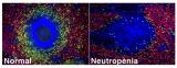 Se descubre la existencia de neutrófilos en el bazo